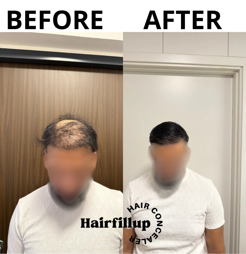 BATIC HAIR CANCELER 30